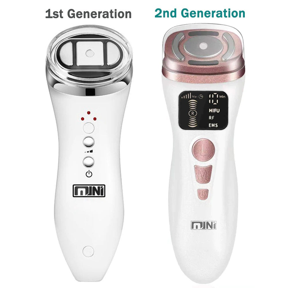 Mini HIFU 2nd Generation